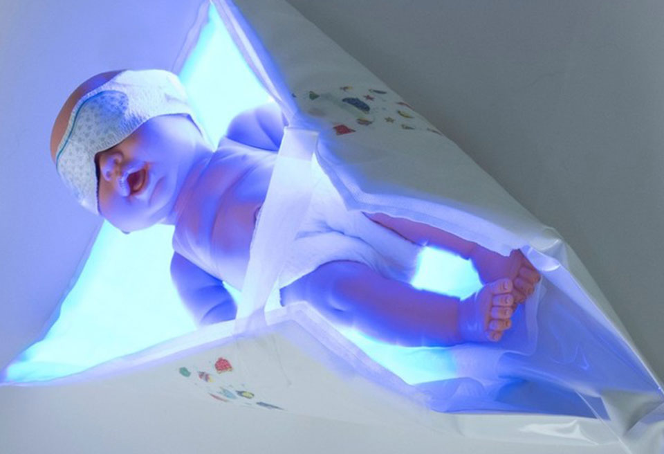 Revolutionary Phototherapy System For Newborns Now Available From Cms